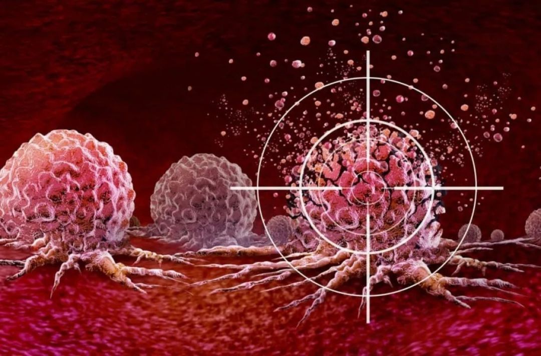 اصلاح سبک زندگی لازمه پیشگیری از سرطان